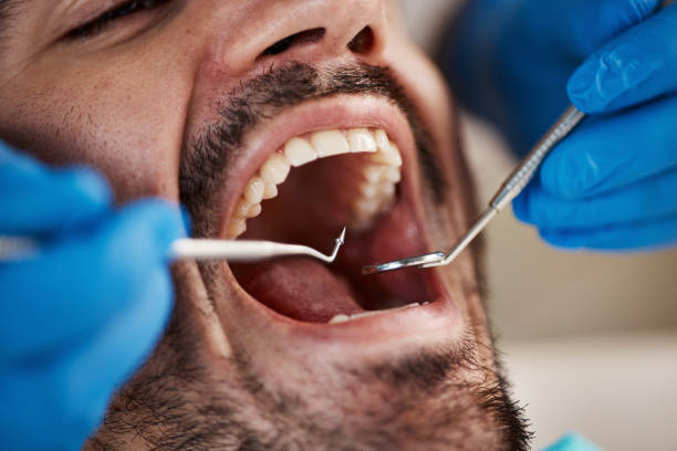 Best Dentist for Severe Toothache  in Lifornia Polytechnic State University, CA